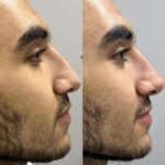 نارین علیزاده